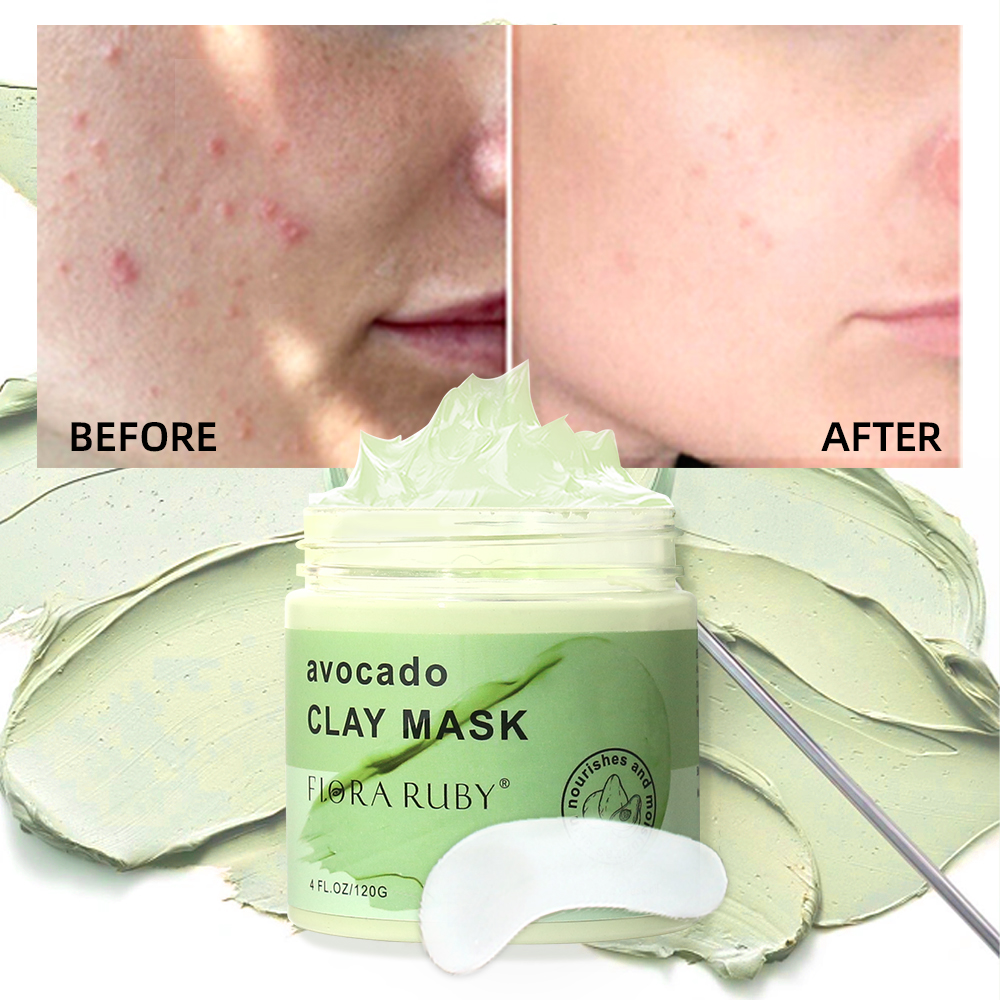 Mud Mask Kaolin - Face Masks Skincare-Avocado Clay Mask Moisturizing