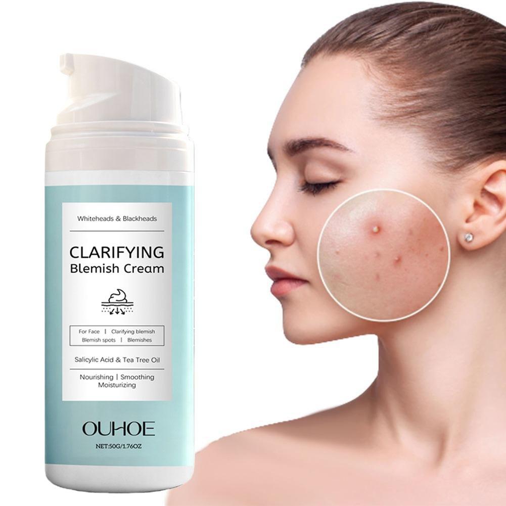 Azelaic Acid Cream - Salicylic Acid Facial Cream for Acne