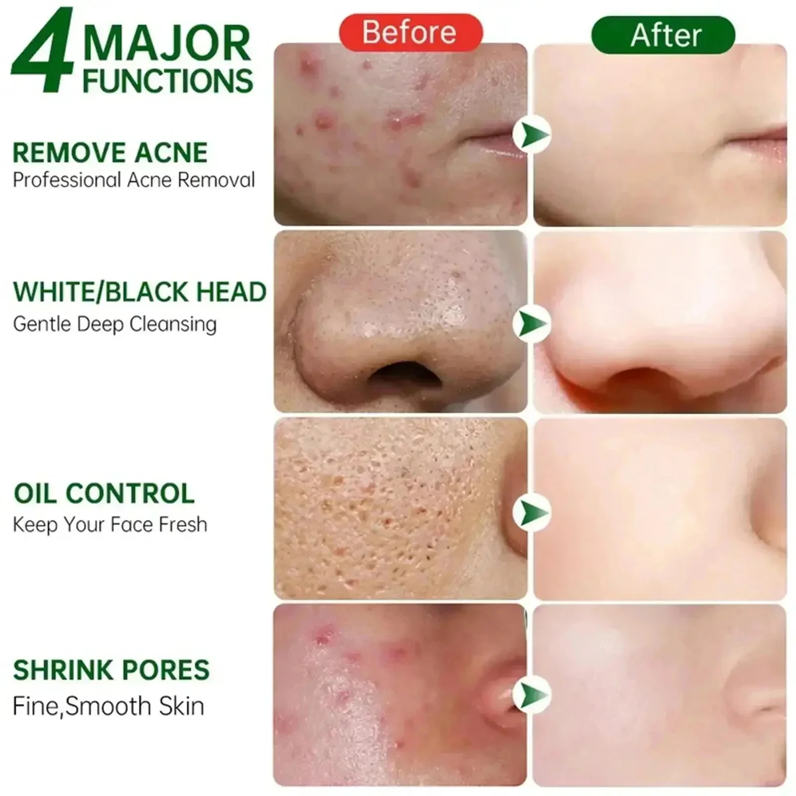 Salicylic Acid Pore Clearing C - Azelaic Acid Cream recension och pris