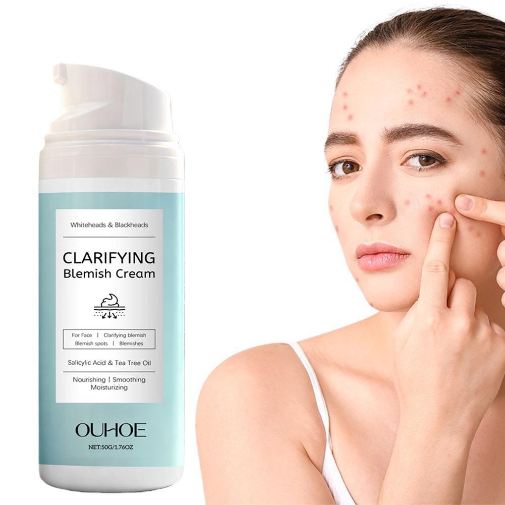 Salicylic Acid Facial Cream fo - Azelaic Acid Cream recension och pris