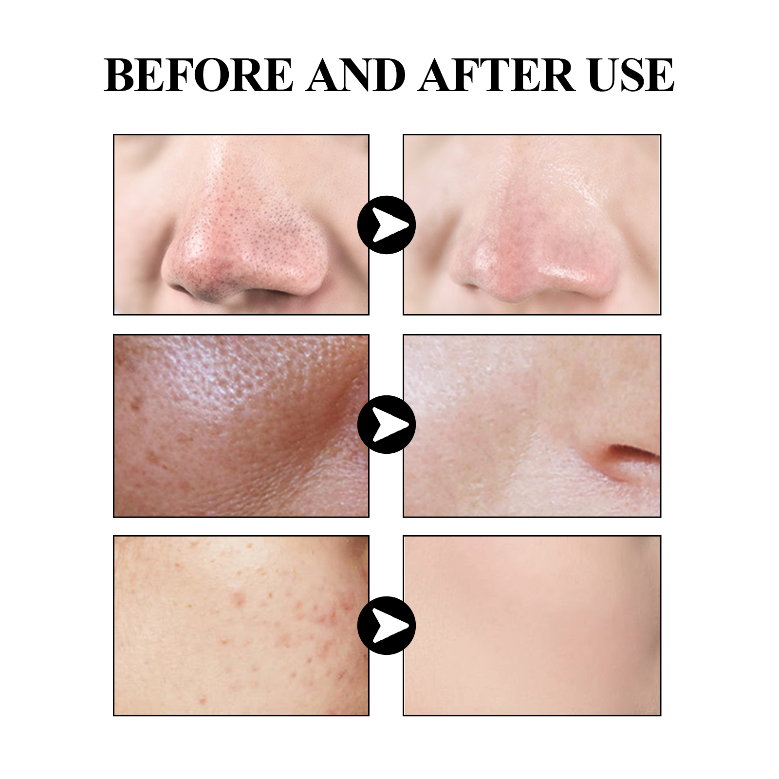 40g Activated carbon facial ma - Mud Mask Kaolin recension och pris