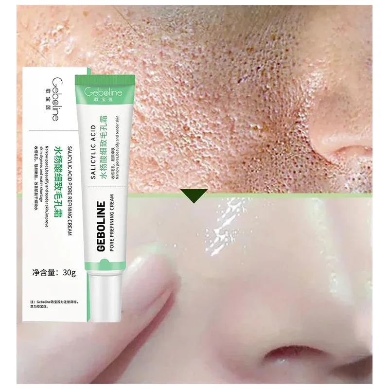 Salicylic Acid Pore Shrinking  - Azelaic Acid Cream recension och pris