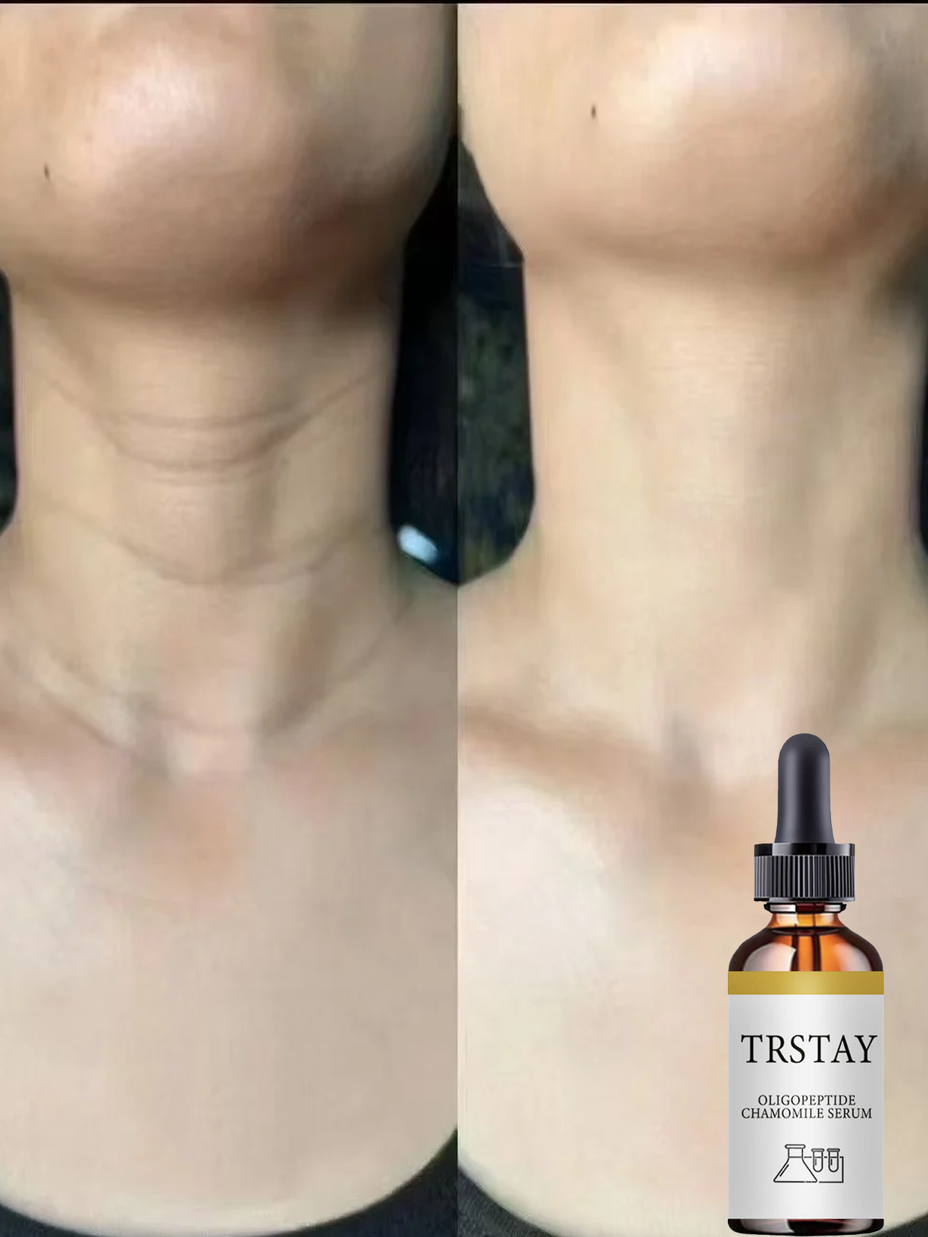 Neck Brightening Cream Gentle  - Skincare Glow Glowing recension och pris