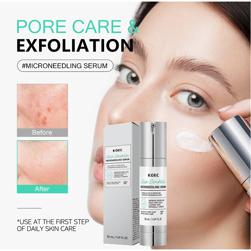 Soothing Microneedle Serum, Ce - Skincare Centella recension och pris