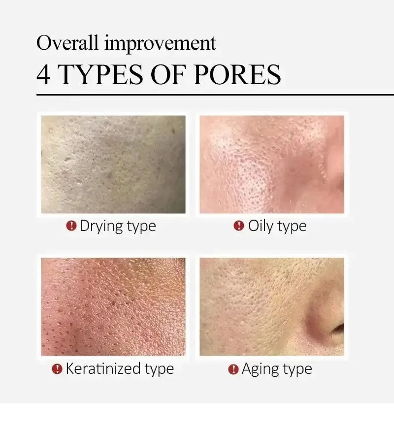 Centella Asiatica Shrink Pores - Skincare Centella recension och pris
