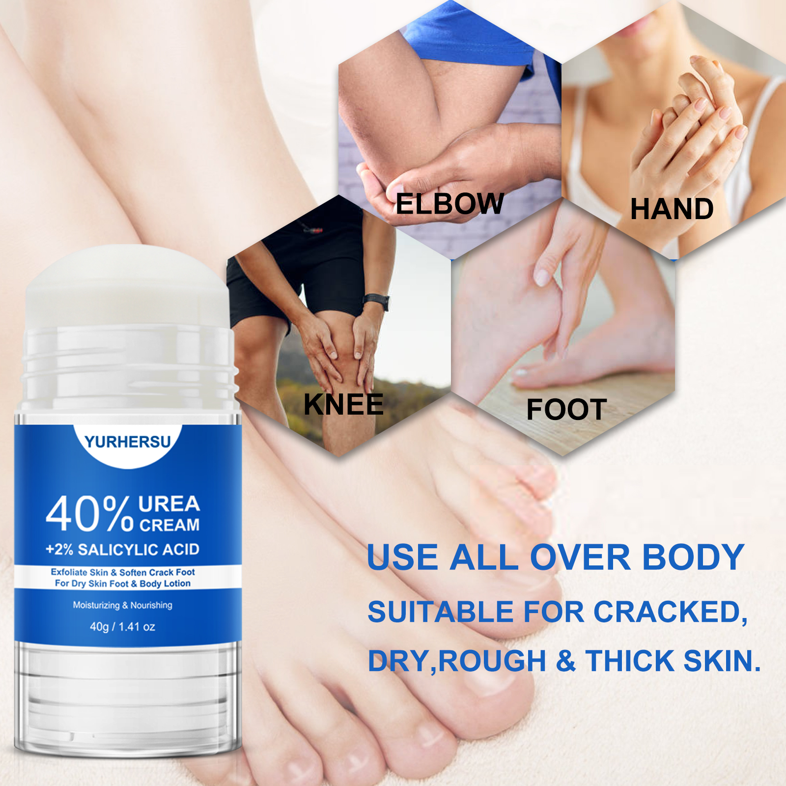 40% Urea Foot Cream Stick - Mo - Azelaic Acid Cream recension och pris